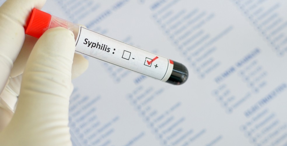 Анализ на сифилис: обнаружено